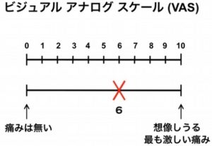 VAS